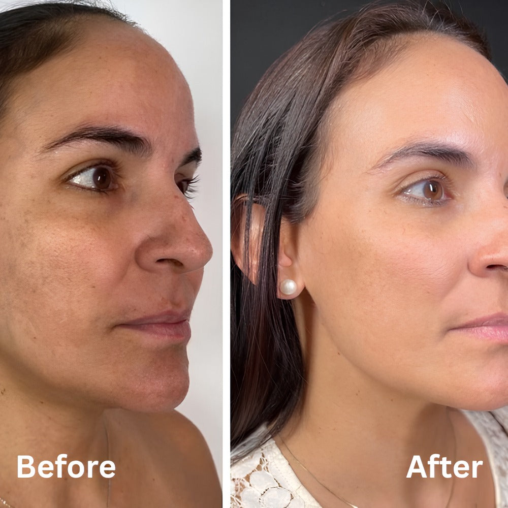 Dr. Melaxin Peel Shot Bundle